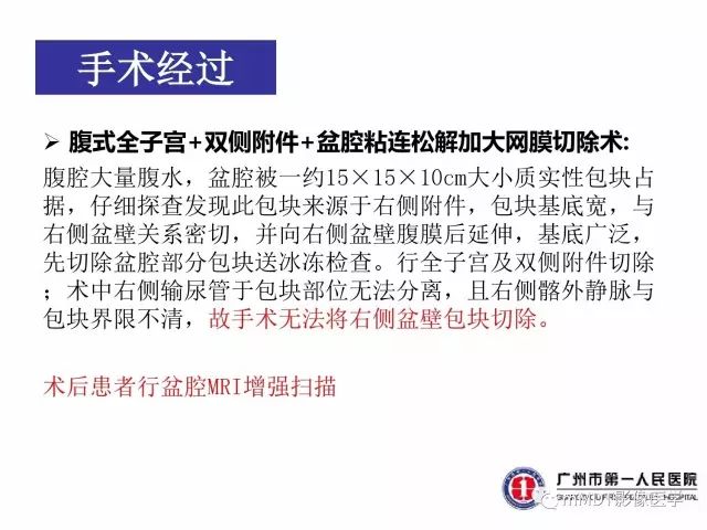 【病例】卵巢PNET1例CT及MR