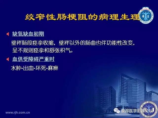 【PPT】急性绞窄性肠梗阻CT诊断