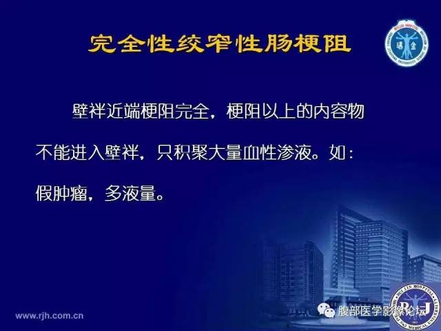 【PPT】急性绞窄性肠梗阻CT诊断
