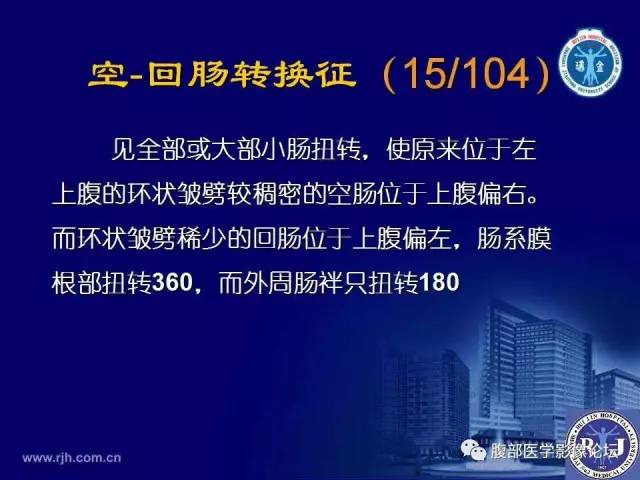 【PPT】急性绞窄性肠梗阻CT诊断