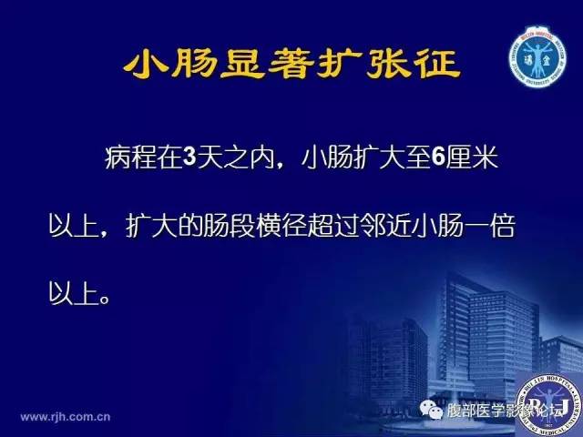 【PPT】急性绞窄性肠梗阻CT诊断