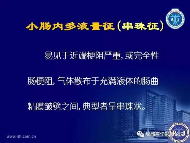 【PPT】急性绞窄性肠梗阻CT诊断