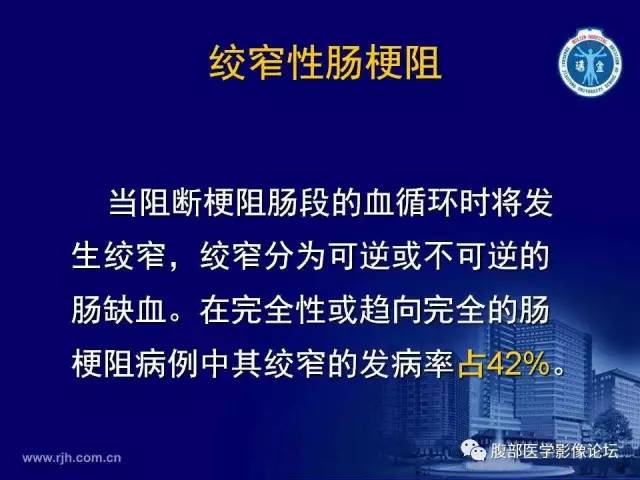 【PPT】急性绞窄性肠梗阻CT诊断
