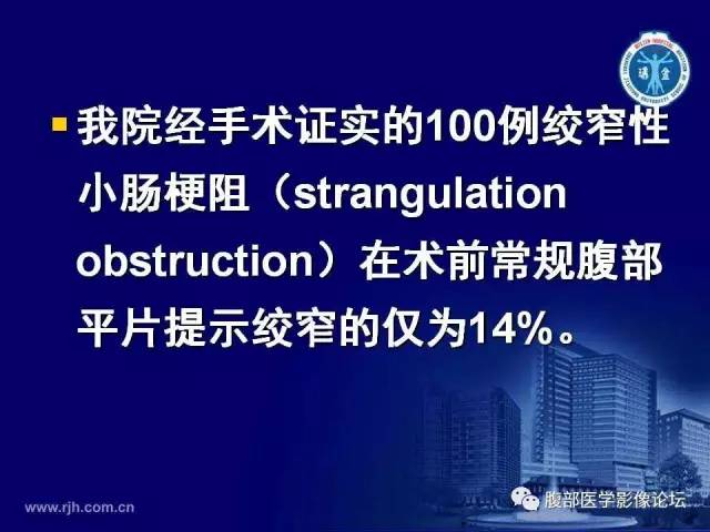 【PPT】急性绞窄性肠梗阻CT诊断