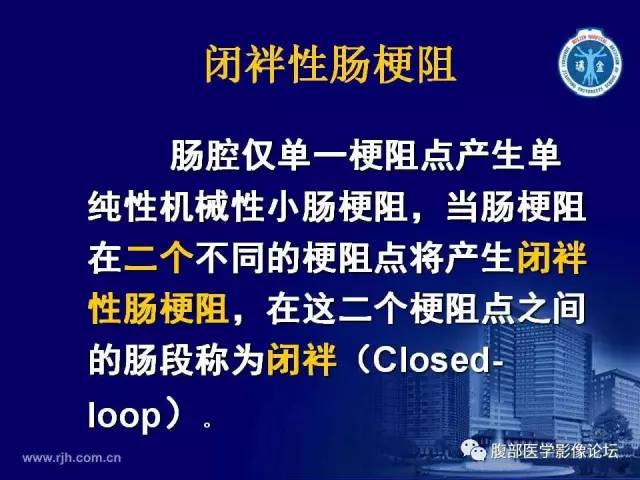 【PPT】急性绞窄性肠梗阻CT诊断