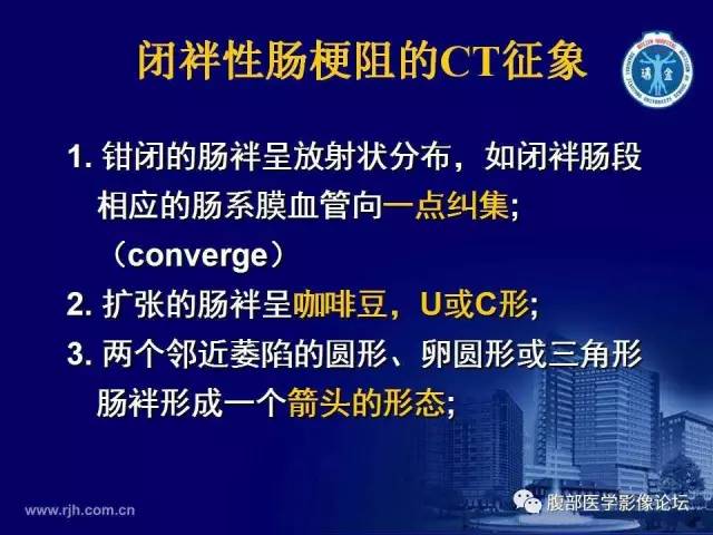 【PPT】急性绞窄性肠梗阻CT诊断