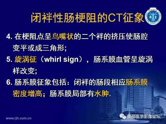 【PPT】急性绞窄性肠梗阻CT诊断