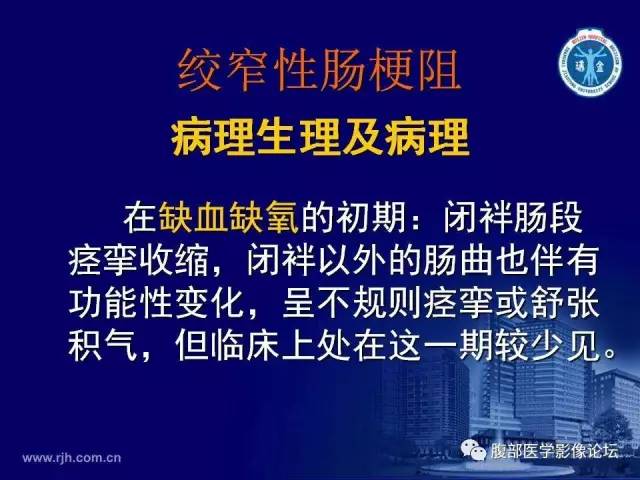【PPT】急性绞窄性肠梗阻CT诊断