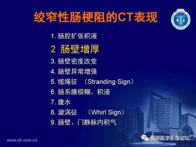 【PPT】急性绞窄性肠梗阻CT诊断