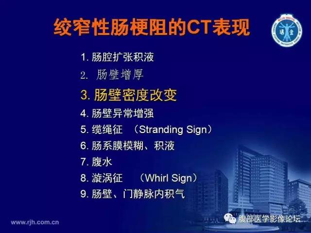 【PPT】急性绞窄性肠梗阻CT诊断