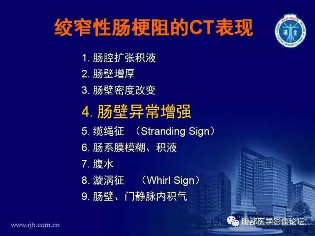 【PPT】急性绞窄性肠梗阻CT诊断