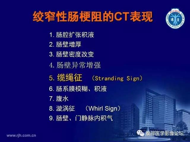 【PPT】急性绞窄性肠梗阻CT诊断