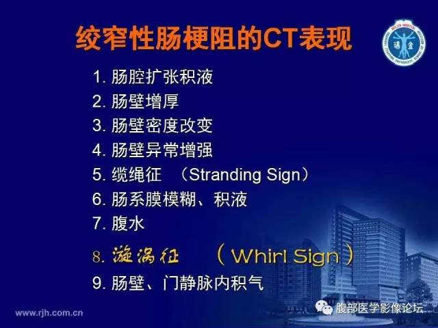 【PPT】急性绞窄性肠梗阻CT诊断
