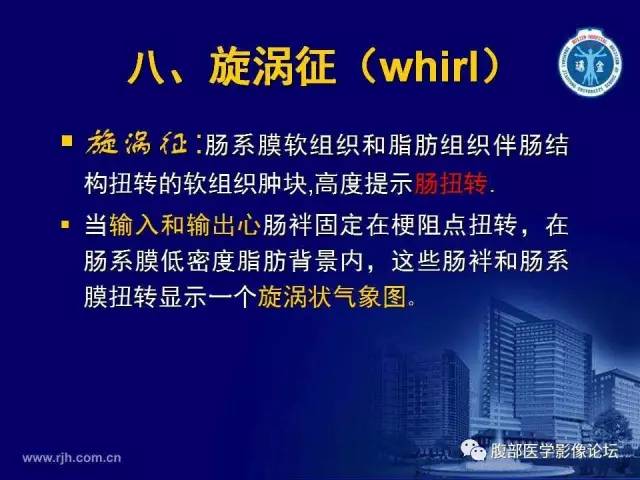 【PPT】急性绞窄性肠梗阻CT诊断