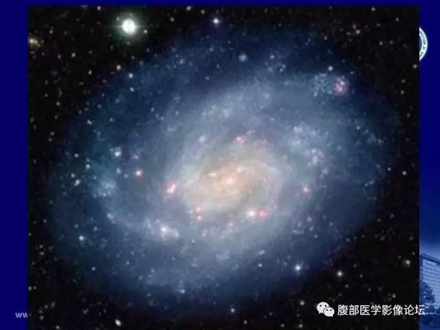 【PPT】急性绞窄性肠梗阻CT诊断