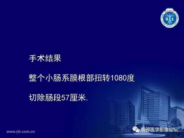 【PPT】急性绞窄性肠梗阻CT诊断