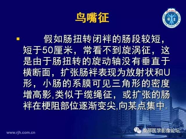 【PPT】急性绞窄性肠梗阻CT诊断