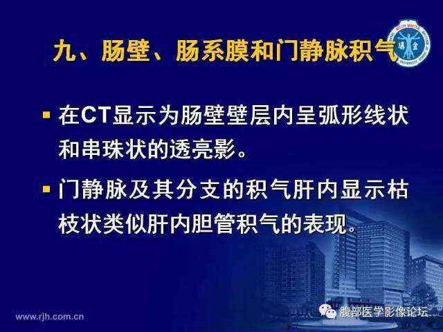 【PPT】急性绞窄性肠梗阻CT诊断
