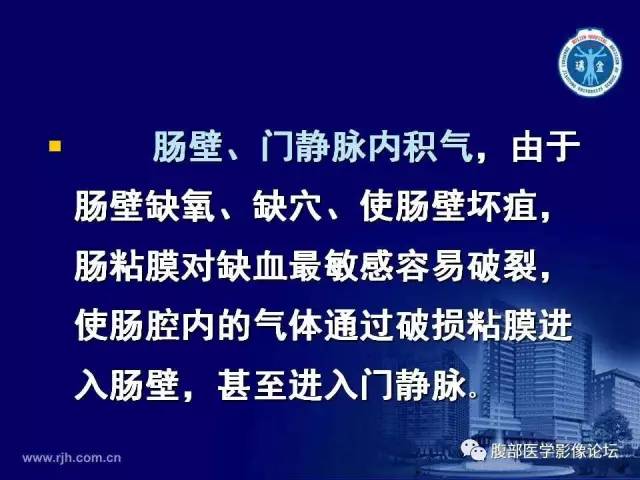 【PPT】急性绞窄性肠梗阻CT诊断