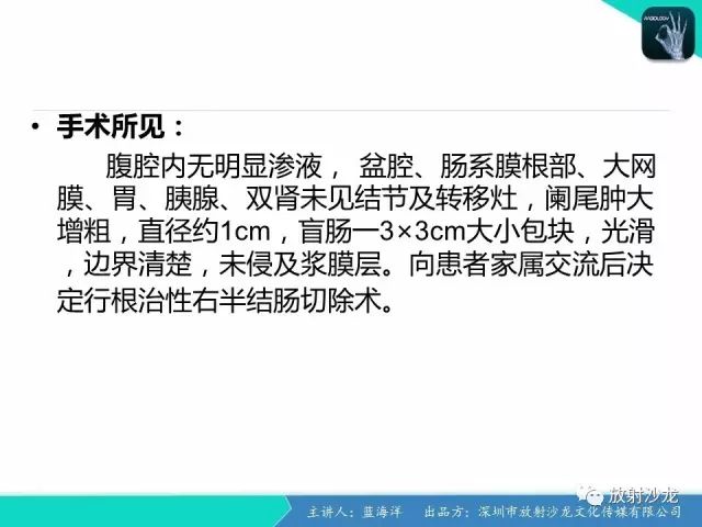 【病例】肠囊肿型重复畸形1例CT