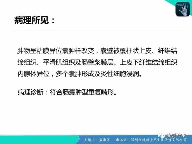 【病例】肠囊肿型重复畸形1例CT