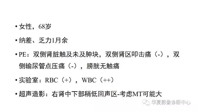 【病例】肾透明细胞癌1例CT影像表现