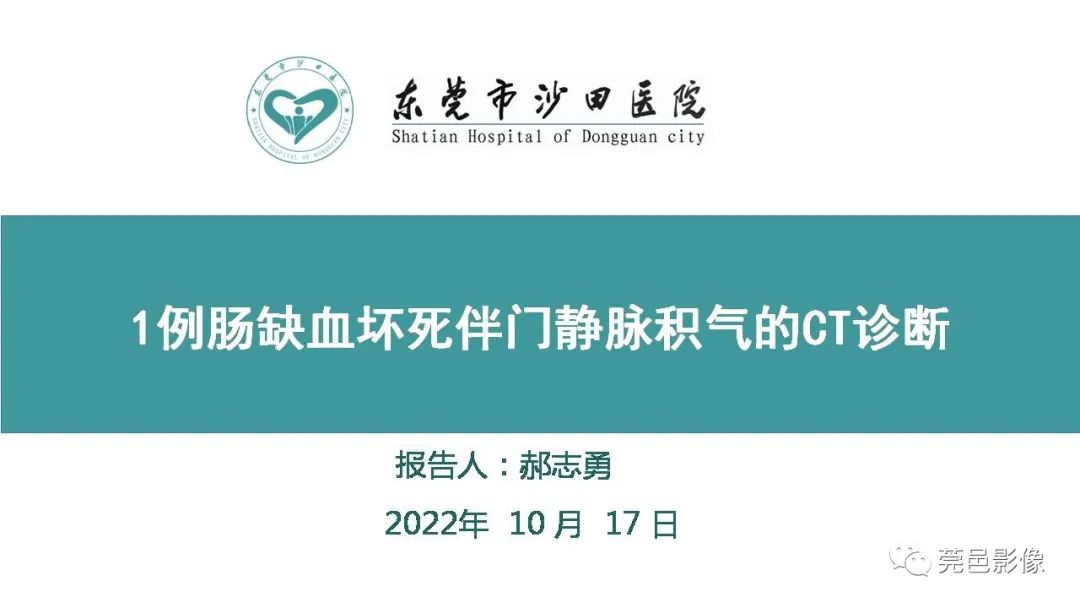 1例肠缺血坏死伴门静脉积气的CT诊断
