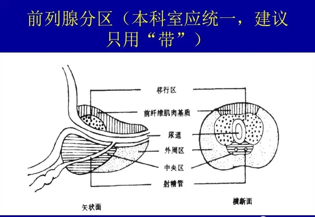 【PPT】前列腺癌MRI诊断再认识-40