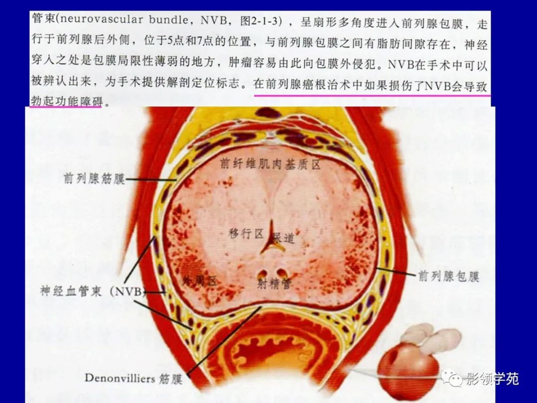 【PPT】前列腺癌MRI诊断再认识-45