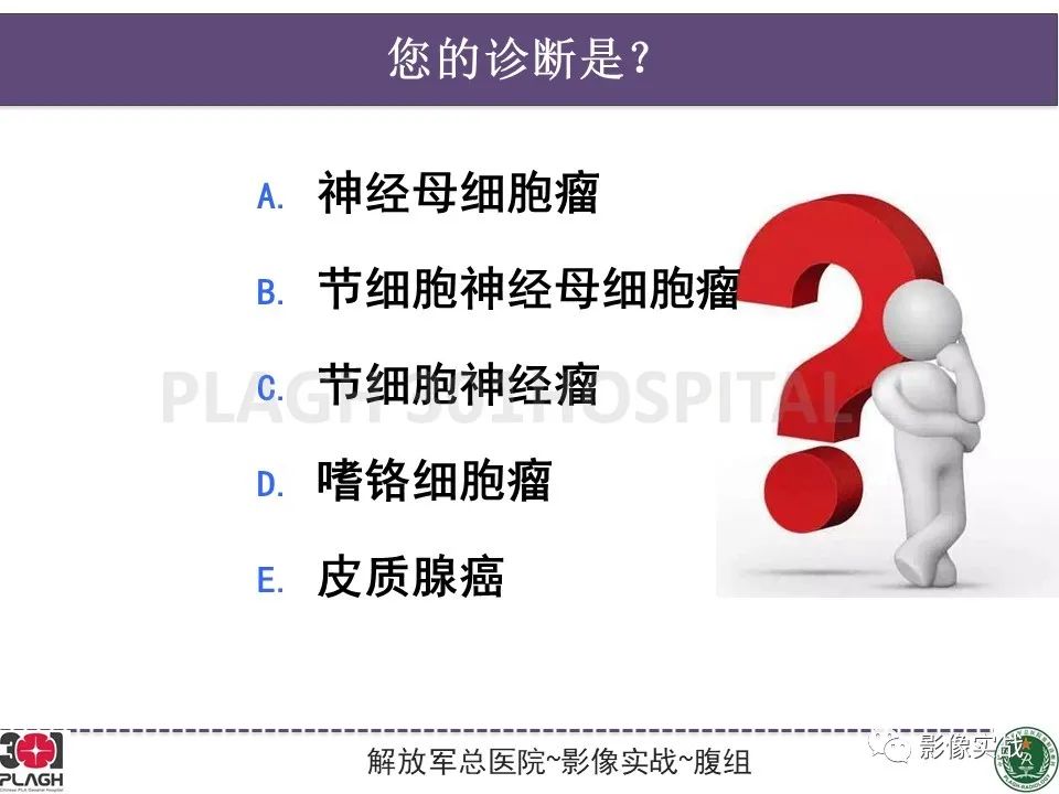 【病例】节细胞神经母细胞瘤1例CT解析思路-16