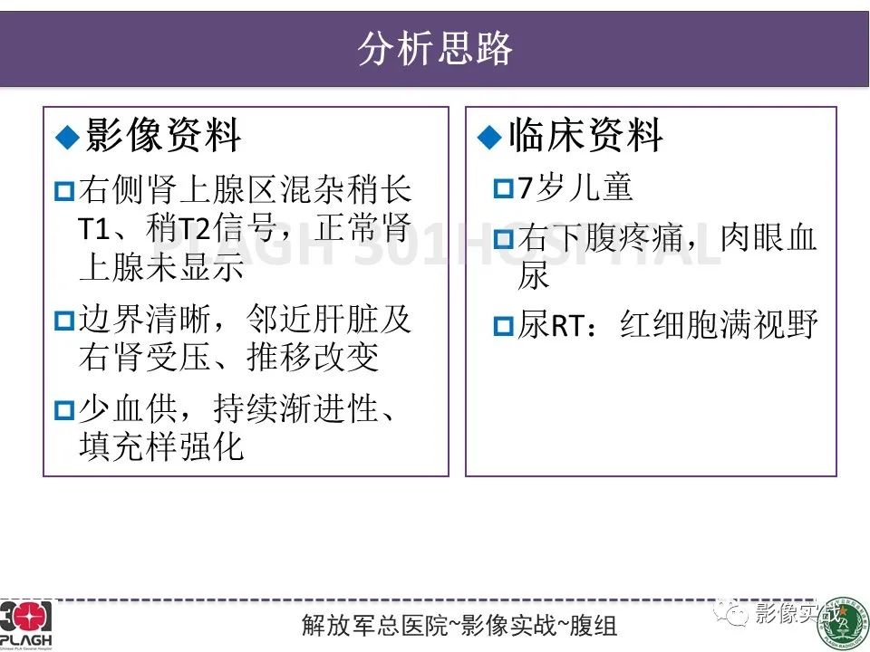 【病例】节细胞神经母细胞瘤1例CT解析思路-18