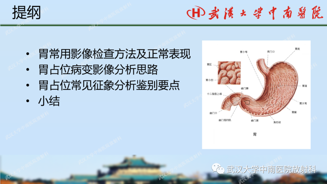 【PPT】胃占位病变影像诊断分析-2