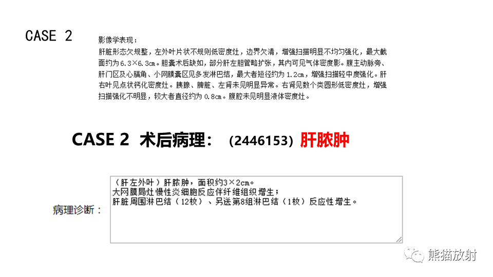 【PPT】肝内胆管细胞癌 VS 肝脓肿-25