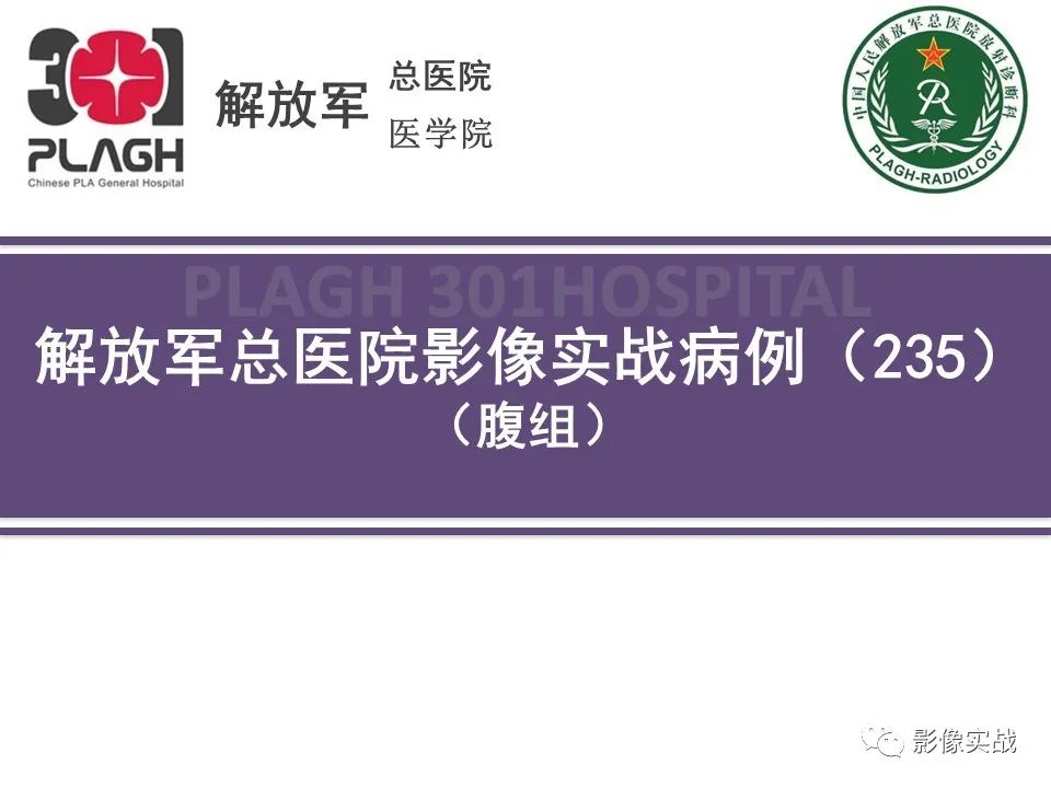 【病例】节细胞神经母细胞瘤1例CT解析思路