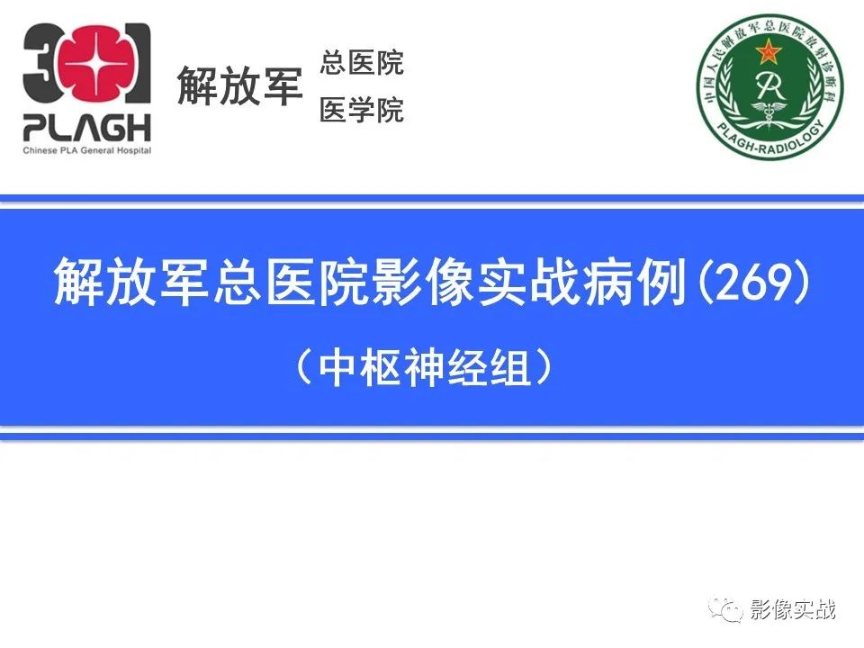 鞍区孤立性纤维瘤1例CT及MR影像