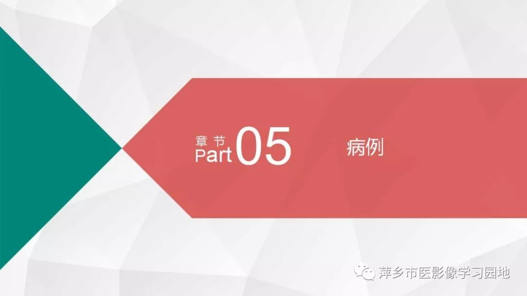 【PPT】可逆性胼胝体压部病变综合征-18