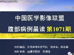 子宫内膜透明细胞癌1例MR