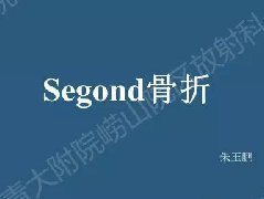 Segond骨折