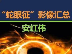 “蛇眼征”影像汇总