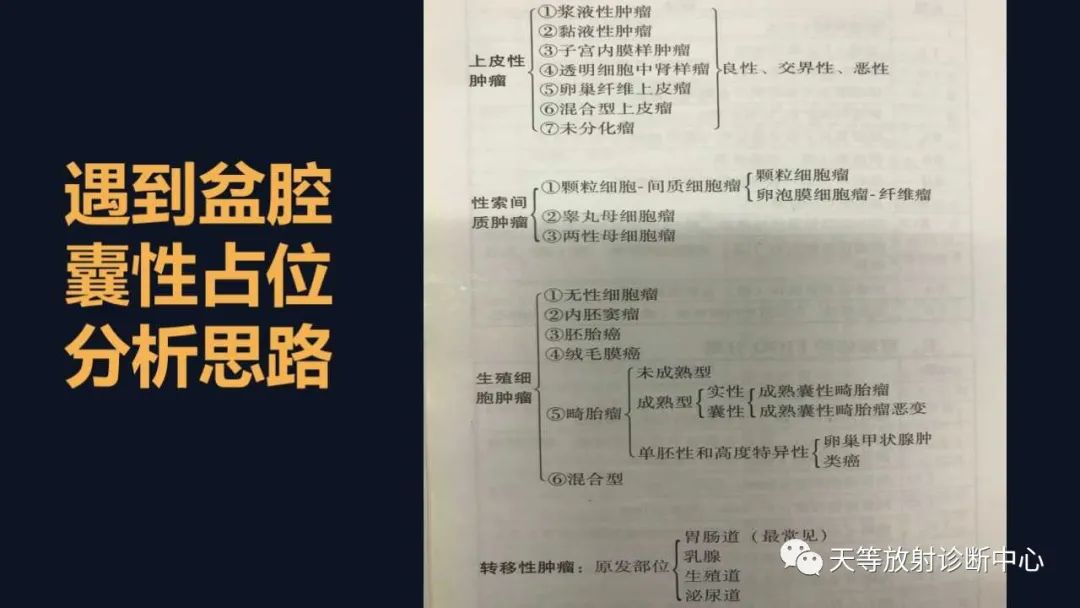 【病例】卵巢囊腺瘤1例MR影像-45