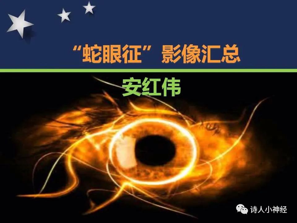 【PPT】“蛇眼征”影像汇总-1