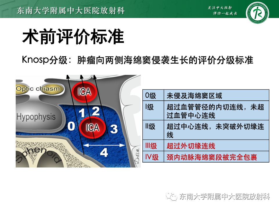 【PPT】斜坡骨质破坏性病变影像诊断-36
