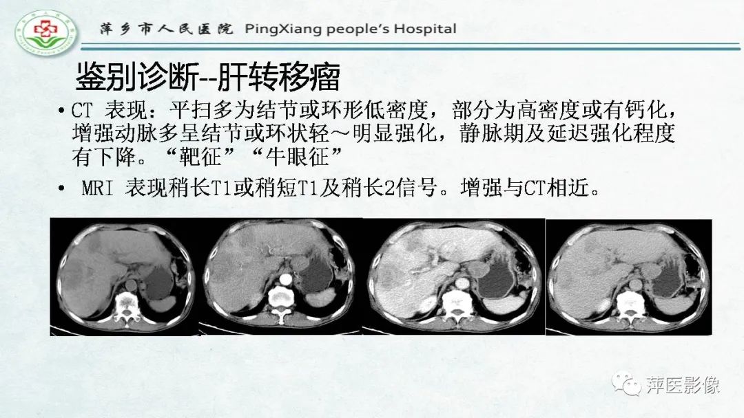 【PPT】HCC影像诊断思路-68