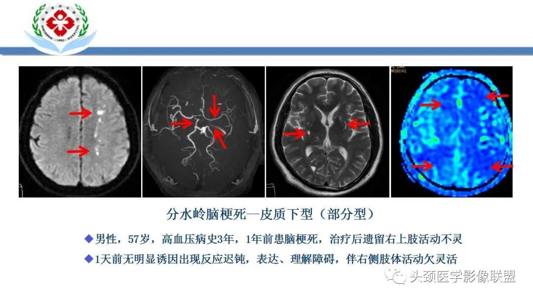 【PPT】特鲁索综合征-26