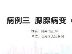 腮腺腺淋巴瘤1例CT影像