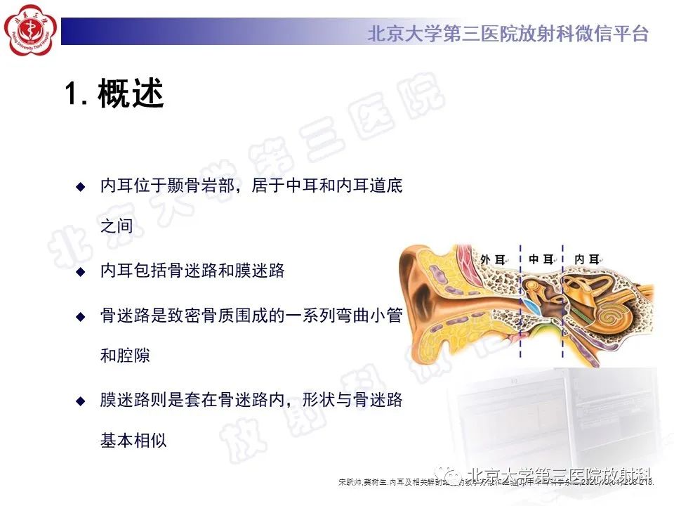 【PPT】内耳发育畸形-11