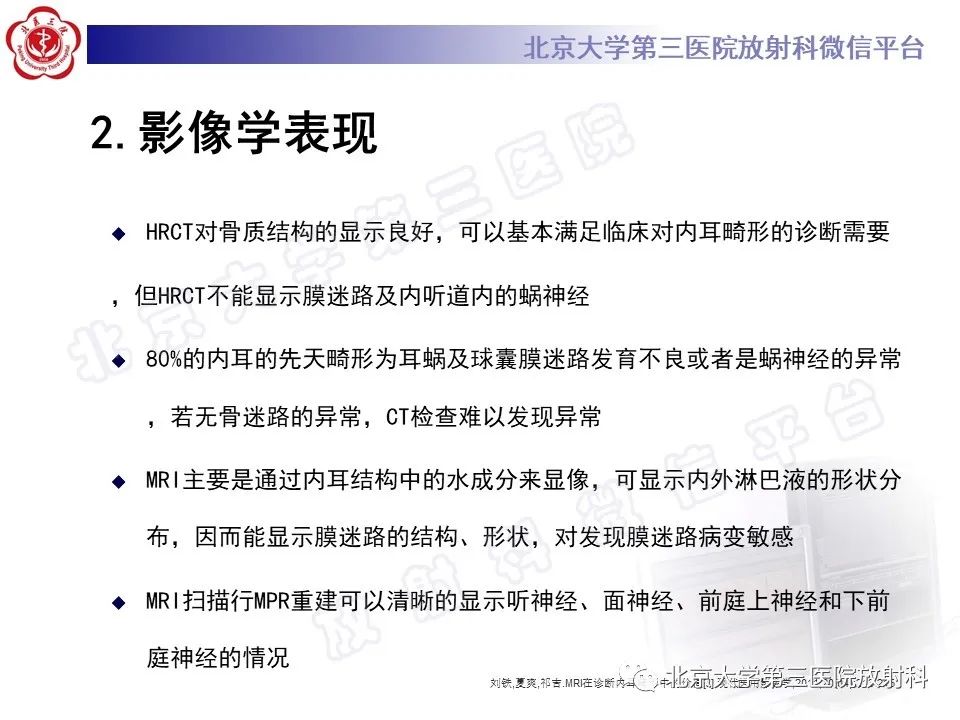 【PPT】内耳发育畸形-15