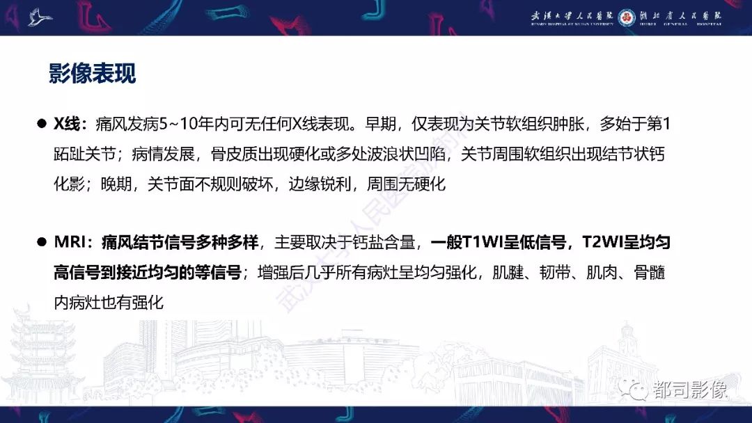 【PPT】关节滑膜弥漫性增厚病变影像诊断-16