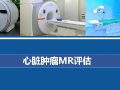 心脏黏液瘤—心脏肿瘤MR评估