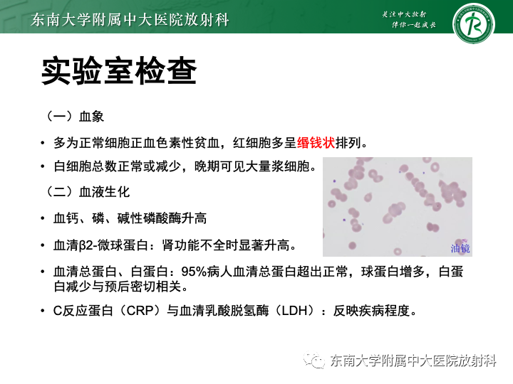 【PPT】多发性骨髓瘤-13